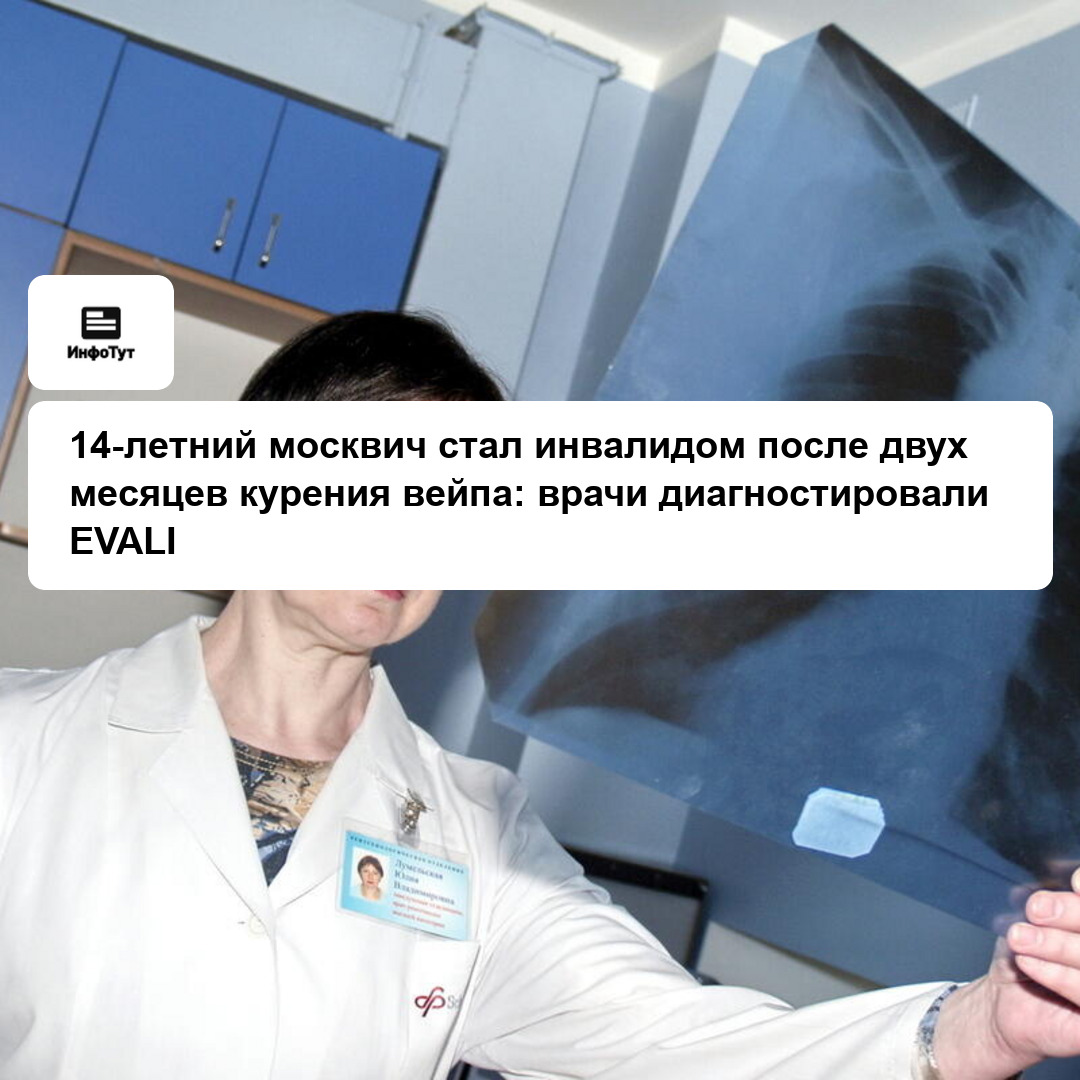 14-летний москвич стал инвалидом после двух месяцев курения вейпа: врачи диагностировали EVALI
